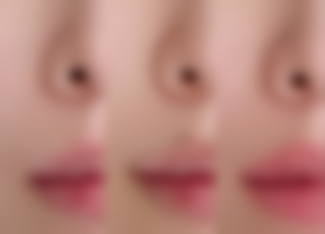 北京星源医疗美容医院金寿信医生丰臀提臀技术怎么样?