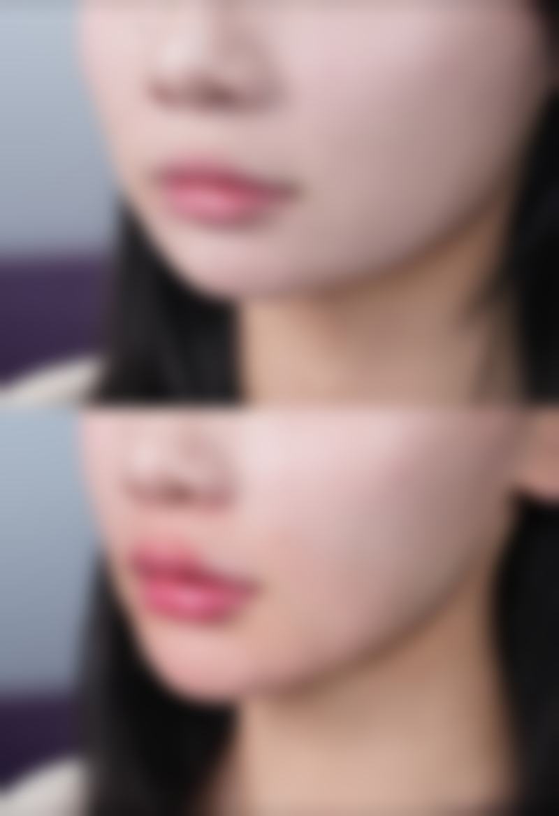 保定禾美仟医疗美容门诊部口碑评价怎么样？