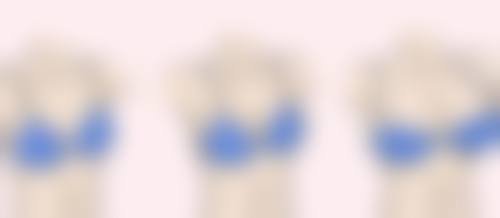 葫芦岛市中 心医院烧伤整形外科张会生医生擅长项目