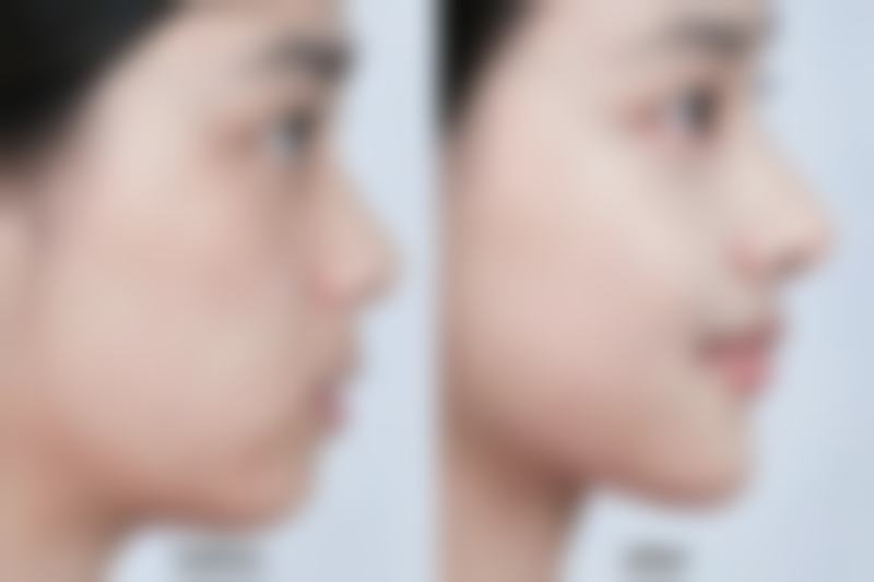 韩国奖杯皮肤科正规吗？