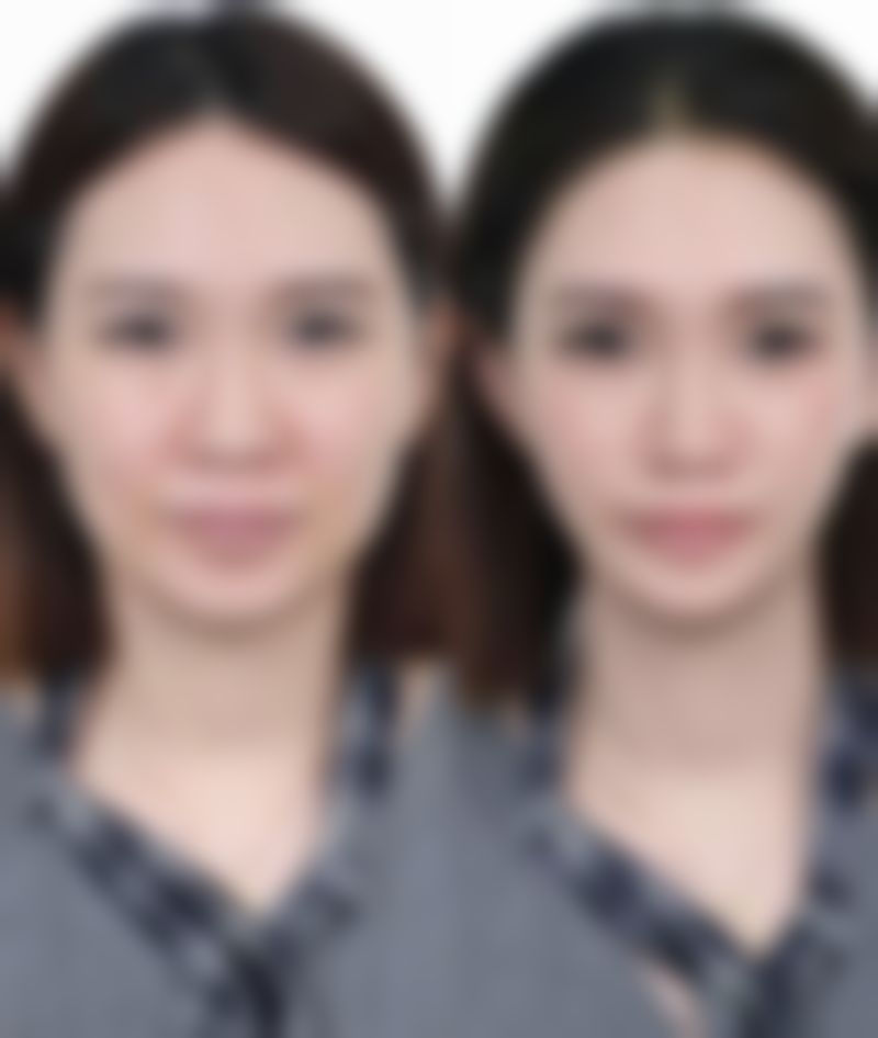 成都美斯迪医疗美容诊所蒋浪医生患者评价