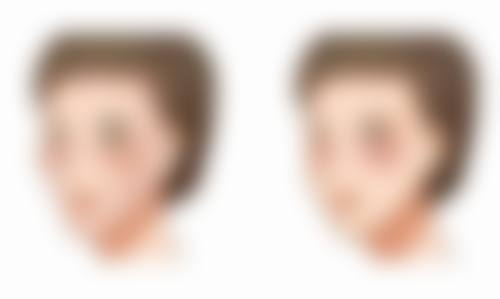 无锡大麦医疗美容诊所李绪医生患者评价