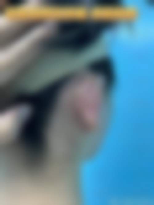 无锡伊尔美整形美容医院口碑评价怎么样?