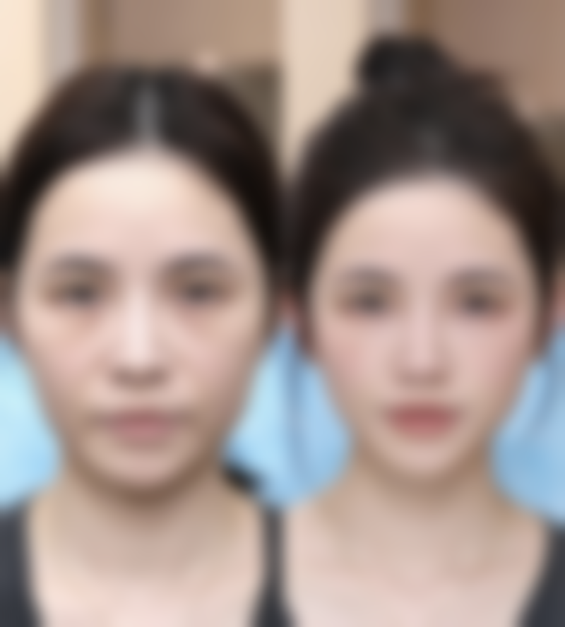 宁波明州医院整形美容中 心邱育德医生患者评价