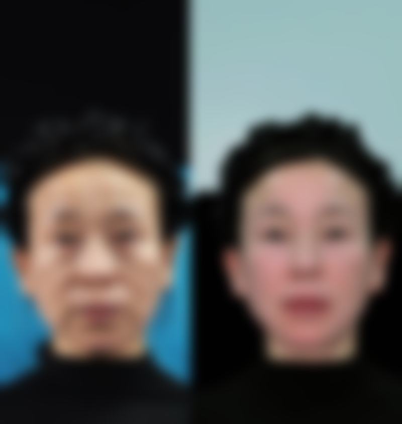 河南大学附属南石医院烧伤整形美容中 心闫静医生患者评价：