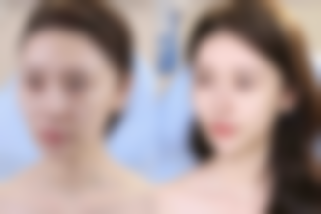 苏州莱之美医疗美容门诊部怎么预约