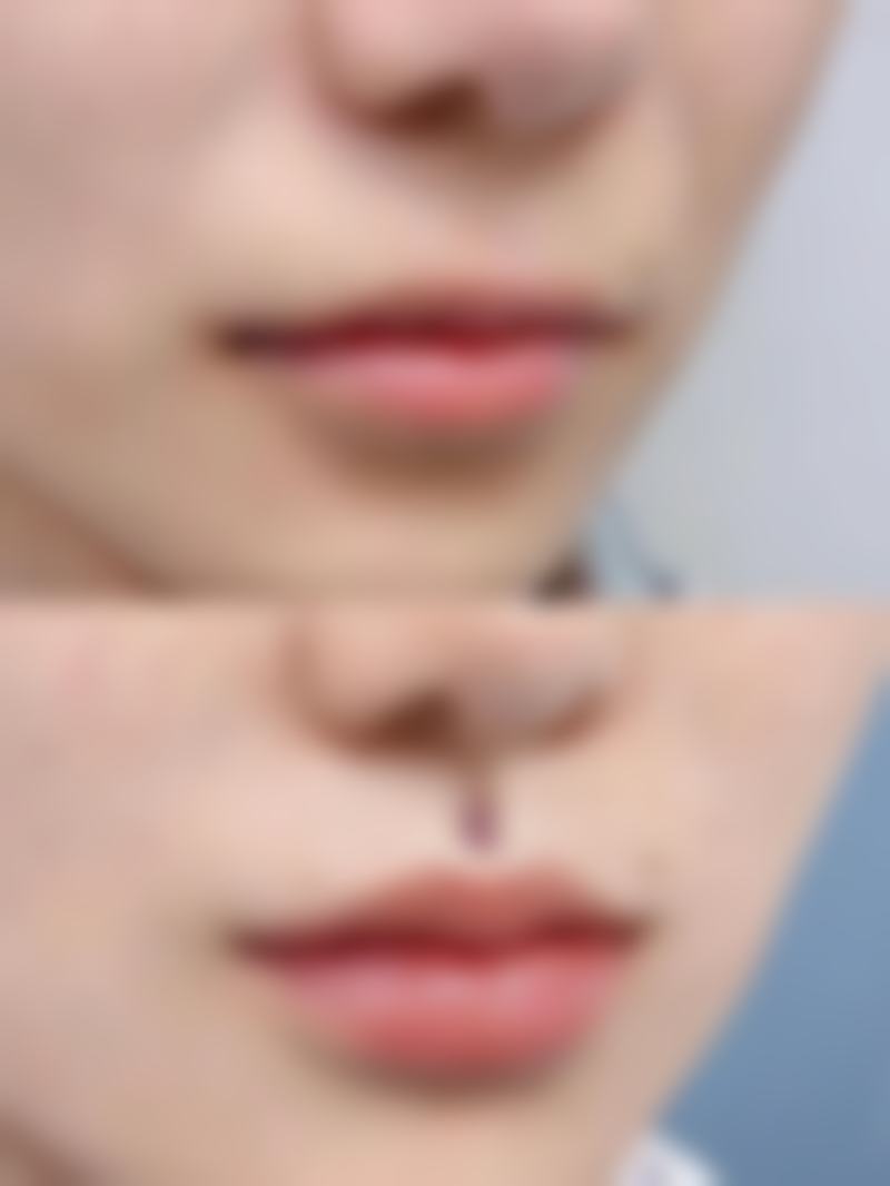 韩国乐颜居皮肤科口碑评价怎么样？