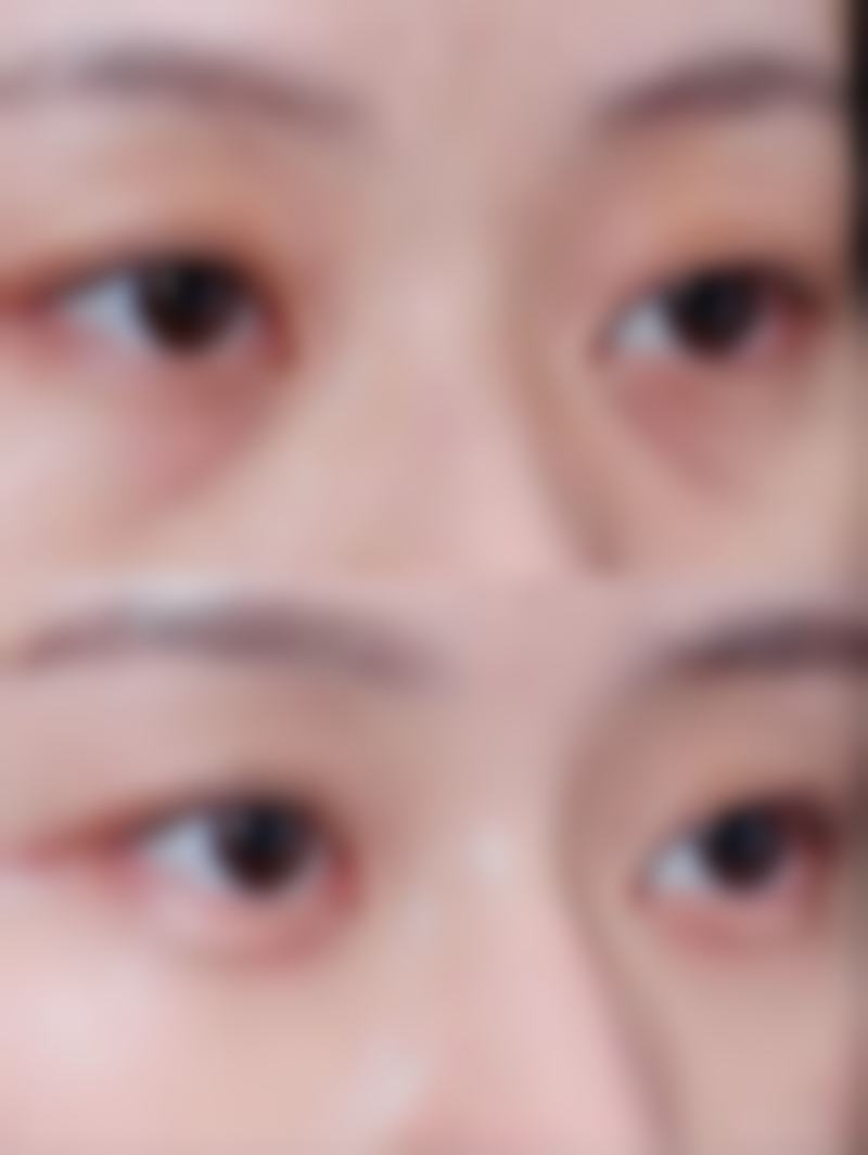 太原美雅枫医疗美容门诊部口碑评价怎么样？