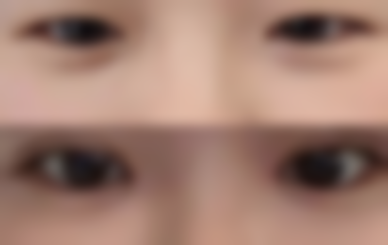 汕头大学医学校第一附属医院医学美容中 心李宇医生社会职称