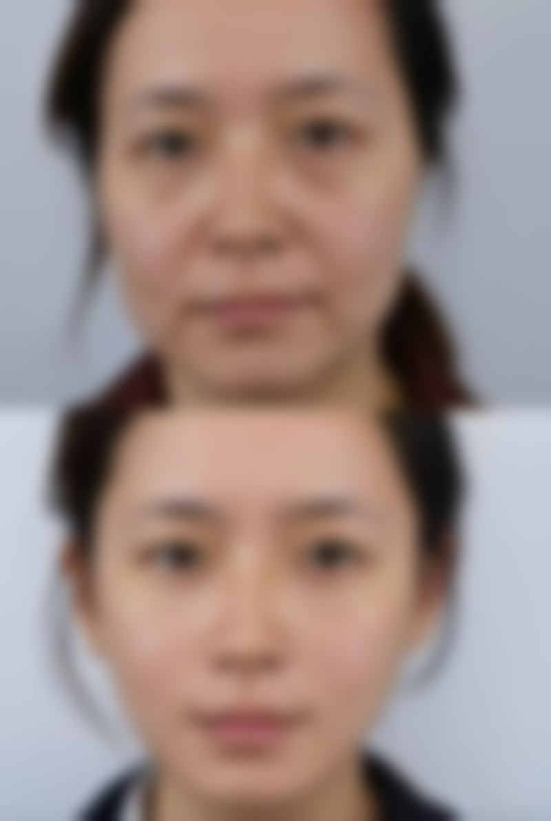 汕头大学医学校第一附属医院医学美容中 心李宇医生收费价格