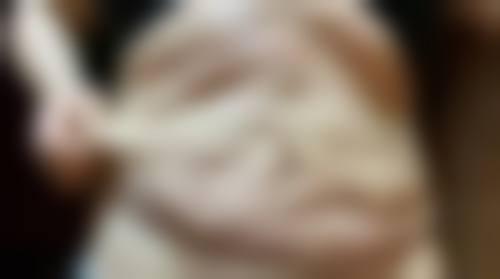 重庆珈溪（菲洛嘉）医疗美容诊所怎么预约