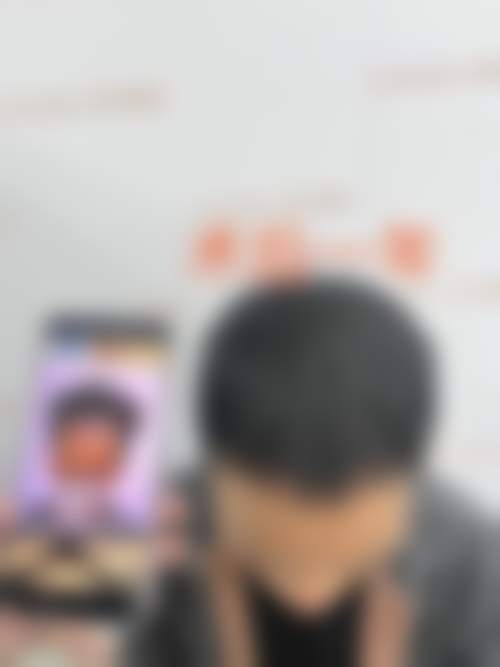 福州碧莲盛植发医院刘敬医生收费价格