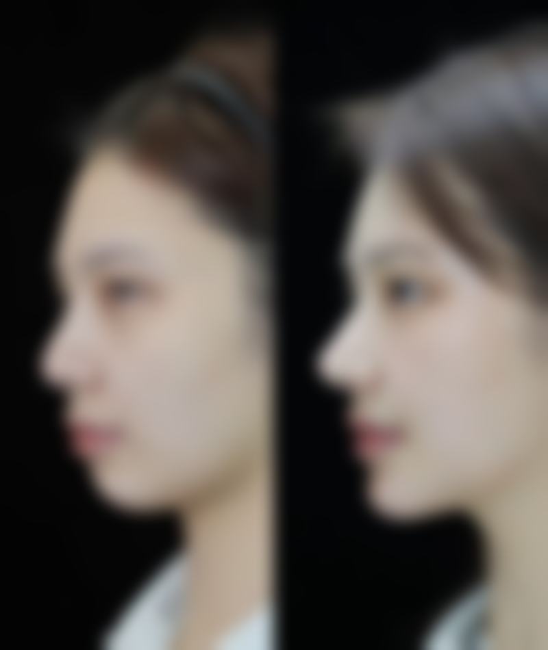 汉中韩美医疗美容(仁爱医院)口碑评价怎么样？