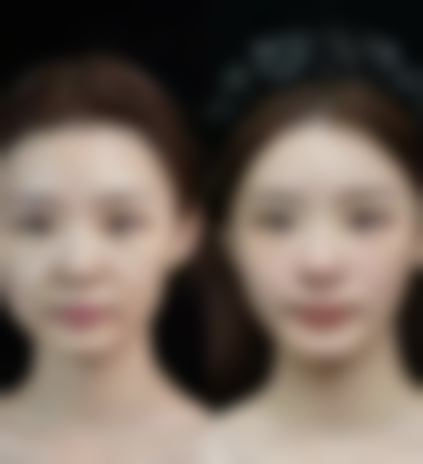 重庆珈溪（菲洛嘉）医疗美容诊所口碑评价怎么样？