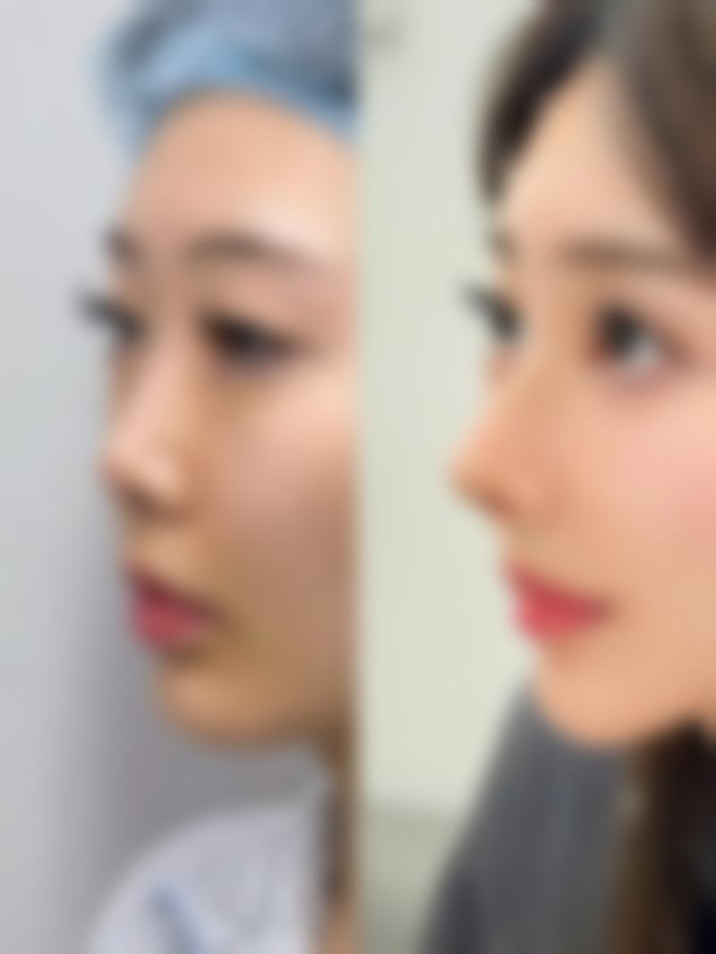 柳州丽人纯韩整形医院正规吗？