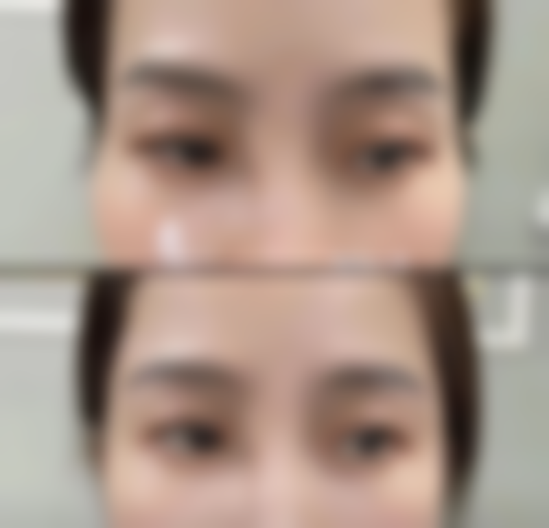 北京星源医疗美容医院马兰花医生擅长项目