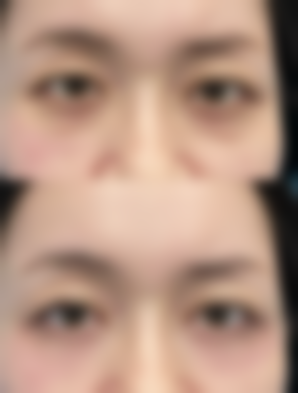 福州沐兮美颜医疗美容诊所怎么预约