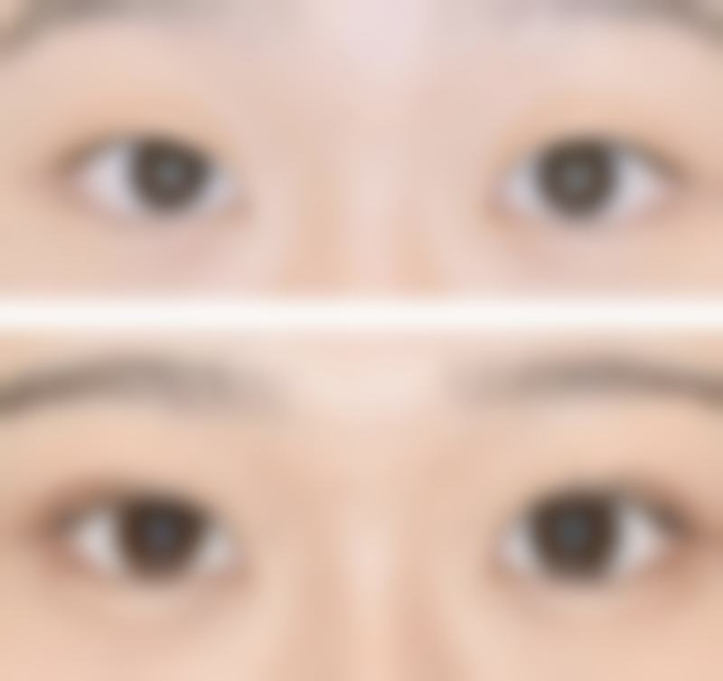 洛阳洛龙赫伦美医疗美容诊所口碑评价怎么样?