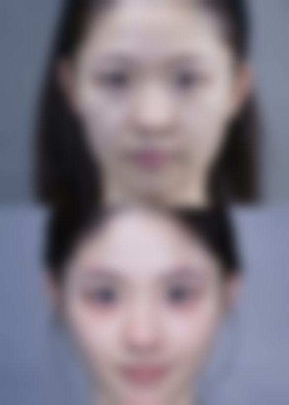 宁波明州医院整形美容中 心周惠能医生收费价格