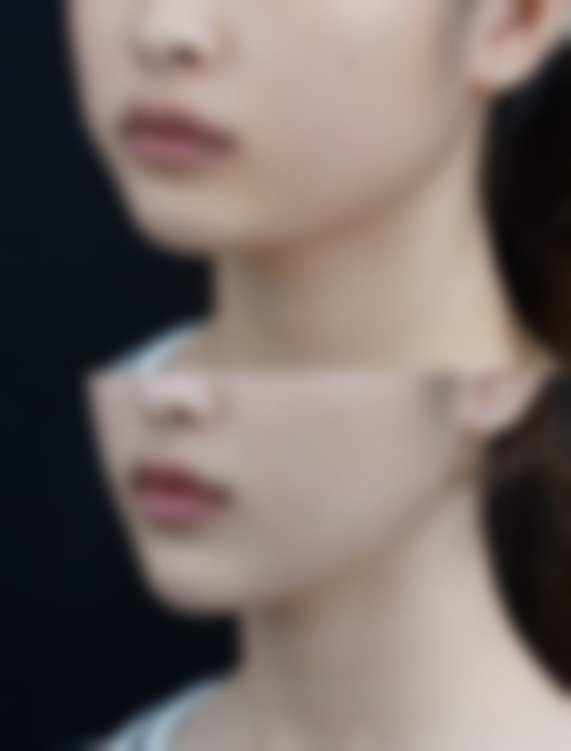 宁波明州医院整形美容中 心周惠能医生患者评价