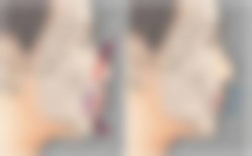 成都菲欧曼医疗美容诊所正规吗？