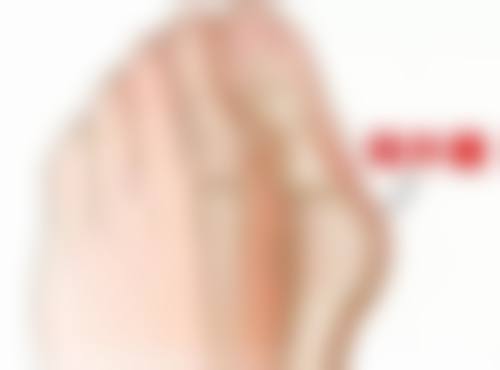 北京叶美人医疗整形医院赵惠春医生擅长项目