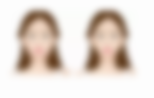 大同清木医疗美容诊所袁强特邀骨干医生医生擅长项目