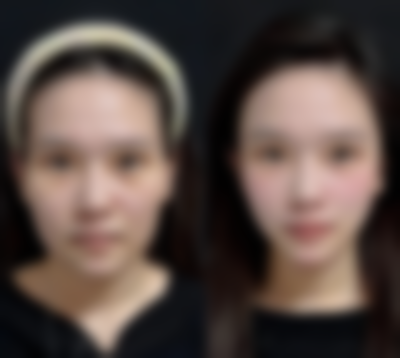 北京叶美人医疗整形医院赵惠春医生患者评价