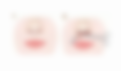 韩国well整形医院河盛允医生擅长项目