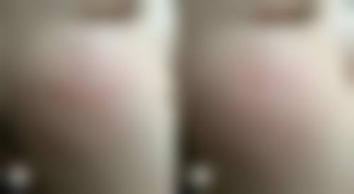 郑州芭比梦整形医院董海燕医生患者评价