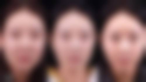 韩国MIND整形外科口碑评价怎么样？