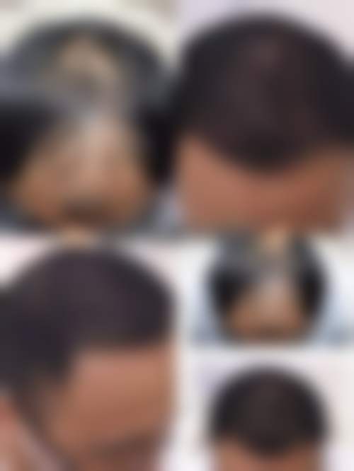 昆明医学校整形美容科口碑评价怎么样？