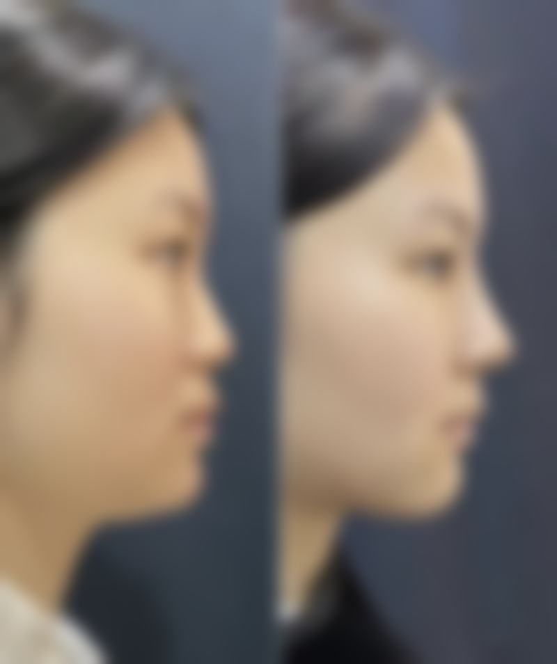 杭州章小蝶医疗美容诊所王秀兰医生预约挂号指南