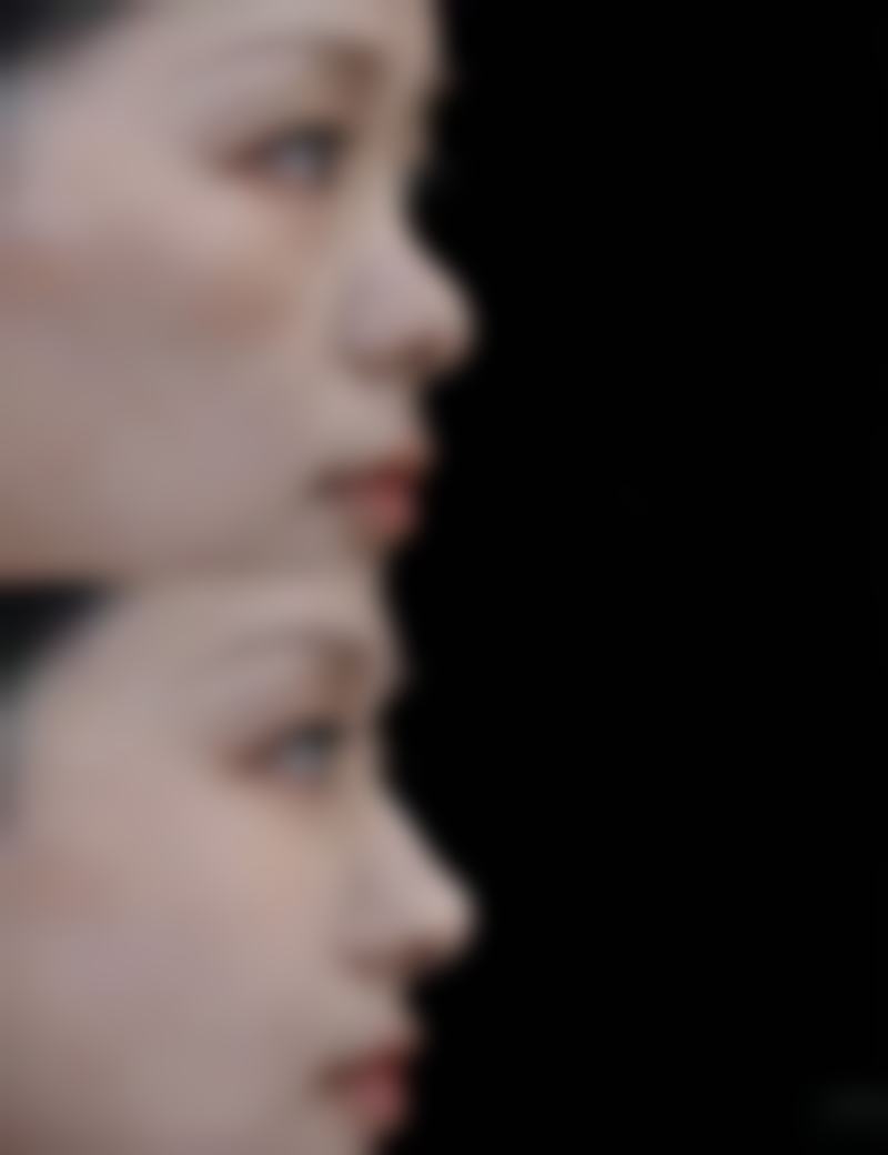 杭州章小蝶医疗美容诊所王秀兰医生患者评价