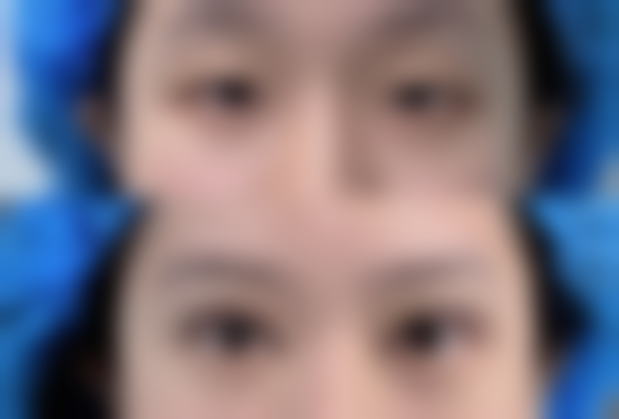 杭州章小蝶医疗美容诊所王秀兰医生擅长项目