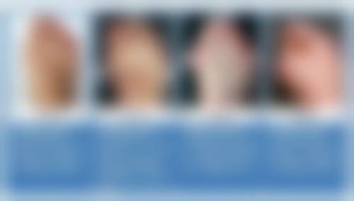 北京星源医疗美容医院马兰花医生患者评价