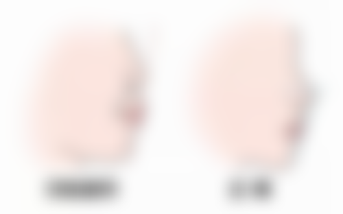 深圳康盈整形门诊部正规吗？