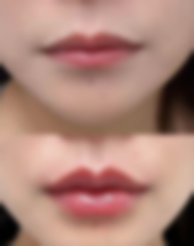 吉安佳美医疗美容诊所正规吗？