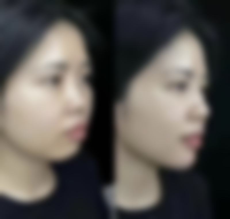 韩国Queenspark整形外科怎么预约