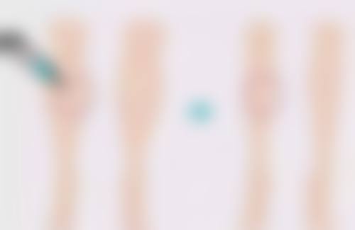 丽江美柏瑞美容医院陈取权医生预约挂号指南