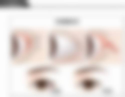 河南大学附属南石医院烧伤整形美容中 心徐文举医生擅长项目