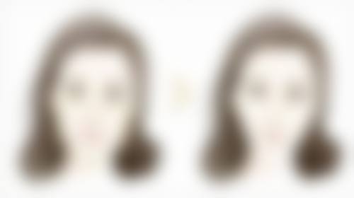 天津阳光树口腔三河门诊部怎么预约