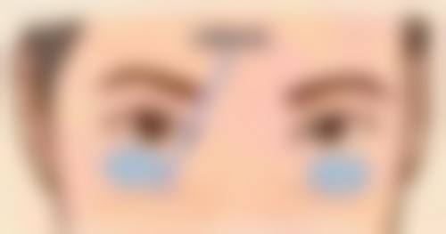 北京斯凯丽雅医疗美容诊所庄庆林医生患者评价