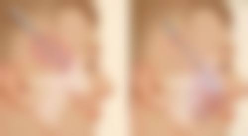 北京斯凯丽雅医疗美容诊所庄庆林医生擅长项目