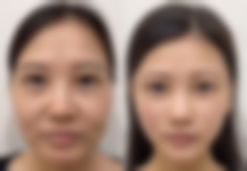 天津阳光树口腔三河门诊部口碑评价怎么样？