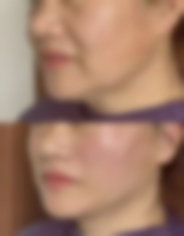 内蒙古鄂尔多斯进禾整形医院口碑评价怎么样？