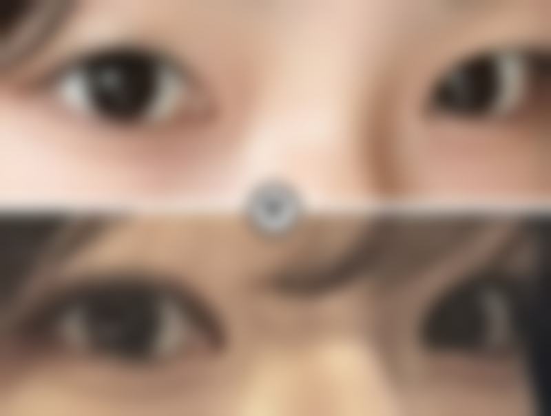 济南美尔雅整形美容诊所正规吗?