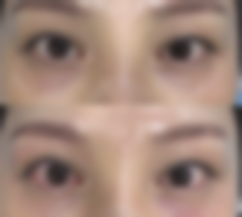 河南大学附属南石医院烧伤整形美容中 心徐文举医生疤痕整形技术怎么样?