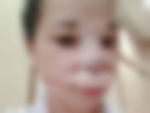 云南昆明华美美莱医美口腔医院口碑评价怎么样？