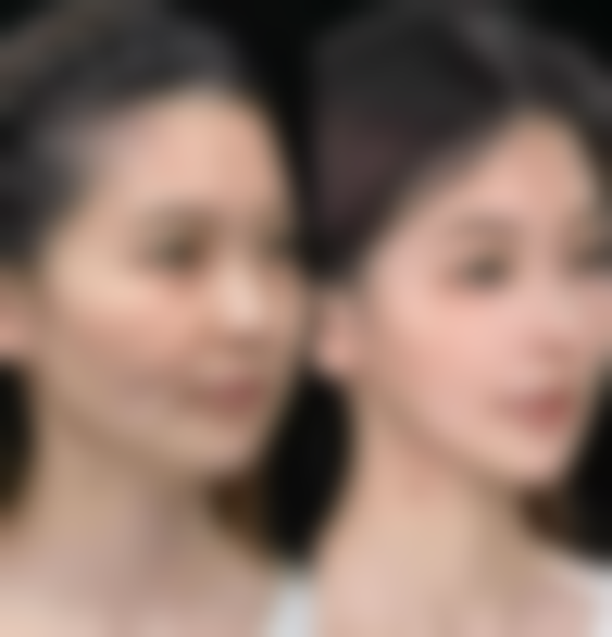 济宁玉烨汇美医疗美容诊所正规吗？